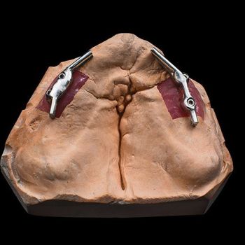 Laboratorio dental en Alcobendas Laboratorio dental en Alcobendas